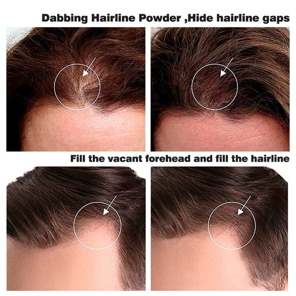 MAYCHEER Hairline Powder: Ultimate Shadow Filler Tool - Picture 3 of 10